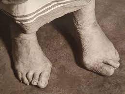 Featured image for “Mother Teresa’s Ugly Feet”